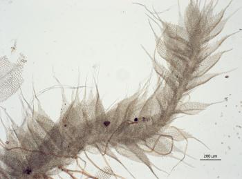 Branch of Fabronia pilifera under a compound microscope, showing the hair-pointed leaves.