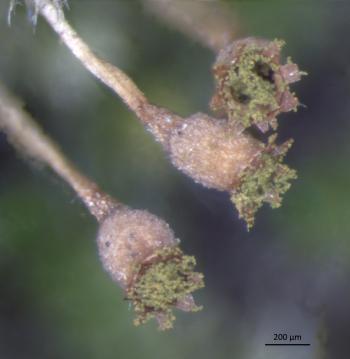 Capsules of Fabronia pilifera showing spores dispersed by the teeth.