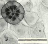 Light micrograph of the epidermis of the leaf of Rotheca louwalbertsii to show the 8-celled head of the peltate hair. (Scale bar = 50 µm)